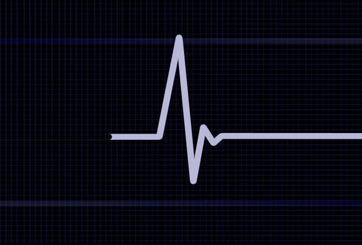Cardiogram. Five seconds loop.