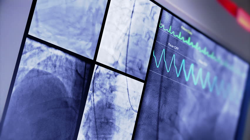 A fictional hospital computer screen monitoring a human heart.  