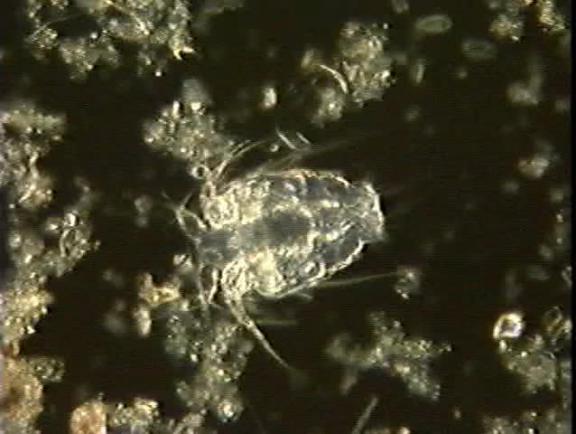 A microscopic darkfield view of a Crustacean larva as it moves around the field with episodic jerks