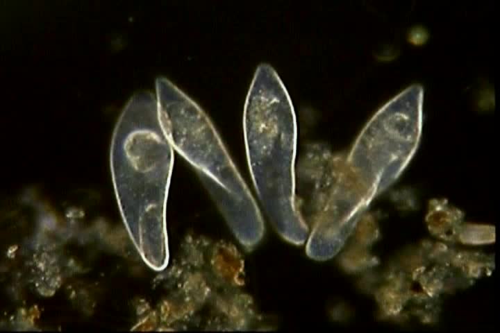 Microscopic educational.  A group of paramecium rotate exhibiting their characteristic slipper morphology.  Darkfield illumination