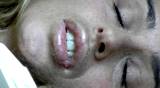 female overdosed 
