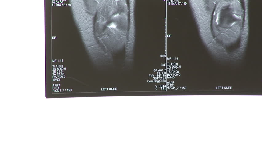 Examining an MRI Scan
