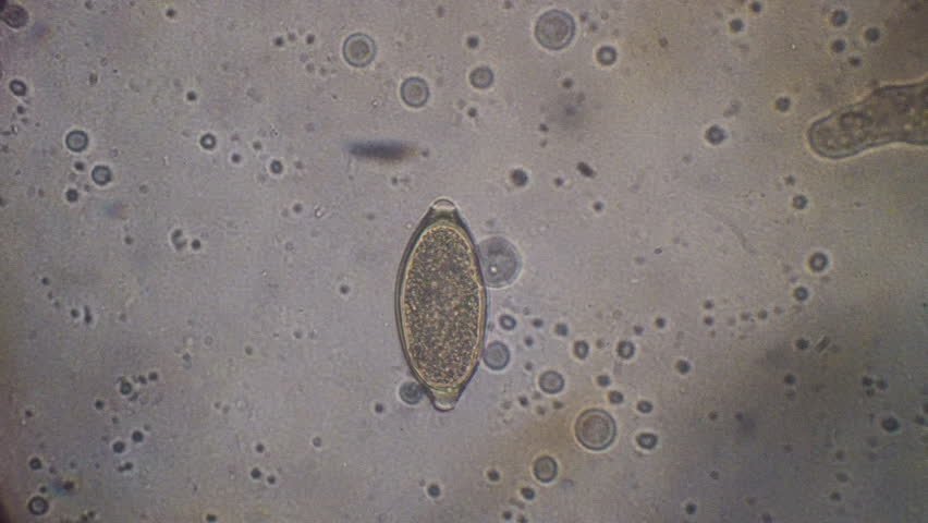 Parasitic Whipworm (Trichuris Vulpis) Egg Under Microscopic Examination