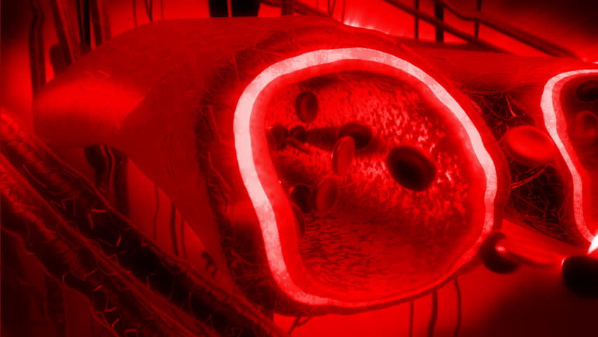 Human blood arteries and veins cut section with back light. Diamaged and distorted vein with problems and behaves strangely.