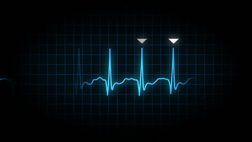 An animated heart monitor EKG line.  Loopable.  With luma matte.
