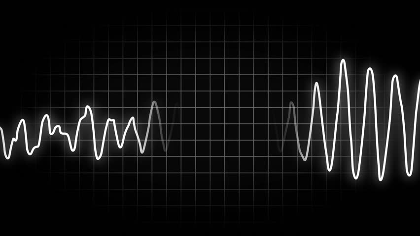 An animated heart monitor EKG line.  Loopable.  With luma matte.