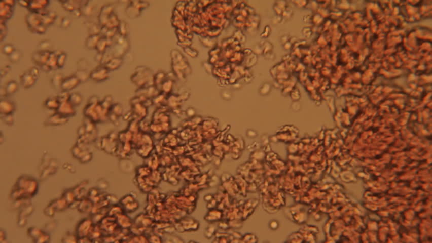 Blood Platelets 400x (HD). Blood Platelets seen at 400x magnification with the aid of a halogen bacteriological microscope. 