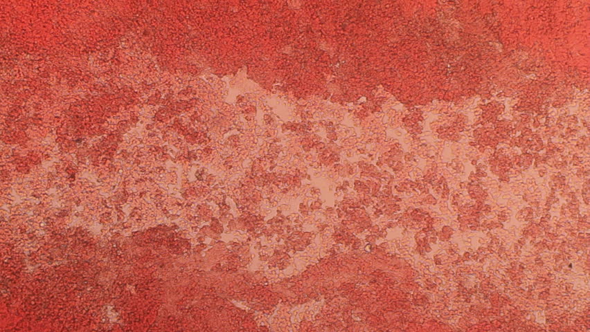 Blood Cell Channel 100x (HD 24p). Blood Platelets seen forming a small pathway at 100x magnification with the aid of a halogen bacteriological microscope.
