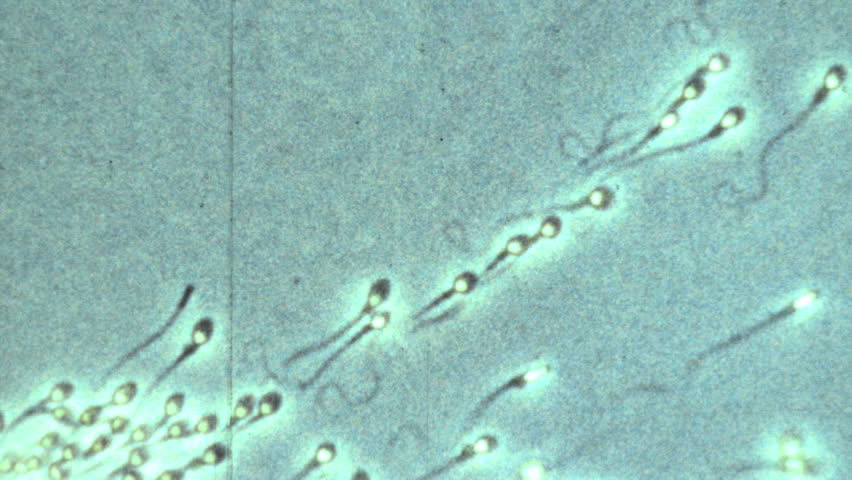 Microscopic Sperm Footage 1