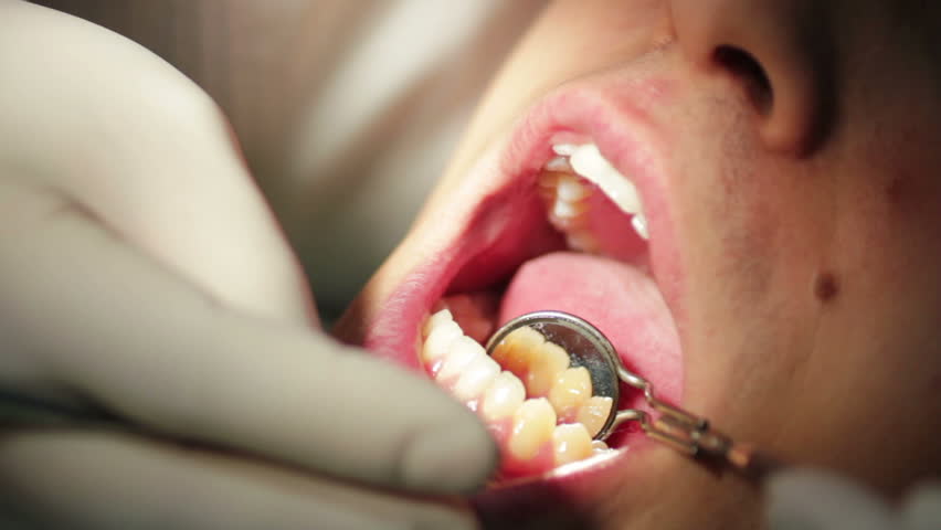 Close-up of patient open mouth during oral checkup