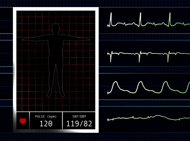 Heart Rate Monitor graphic  DV NTSC video