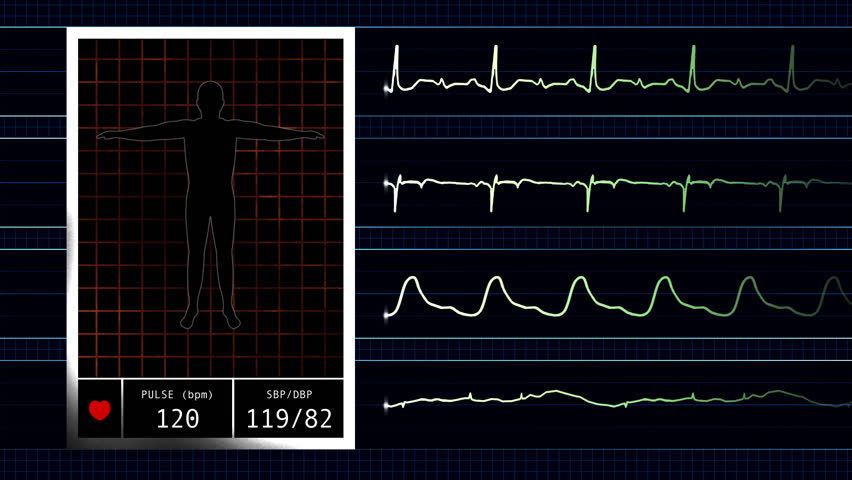 Heart Rate Monitor graphic 1080 HD video