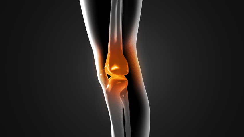 knee pain