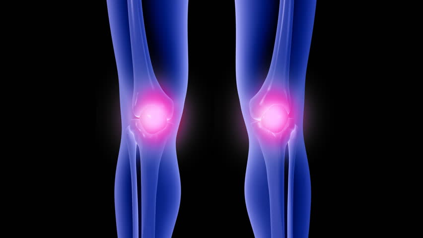 x ray of knee showing knee pain