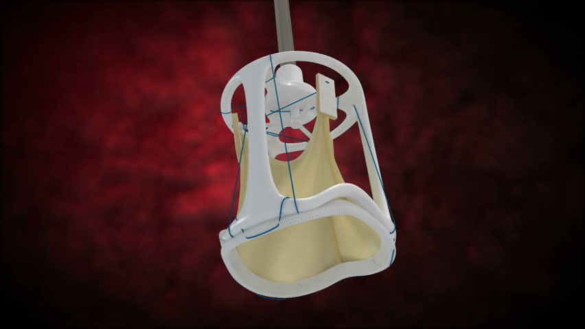 Rotational view of synthetic cardiac valve for surgical procedure aortic vale replacement