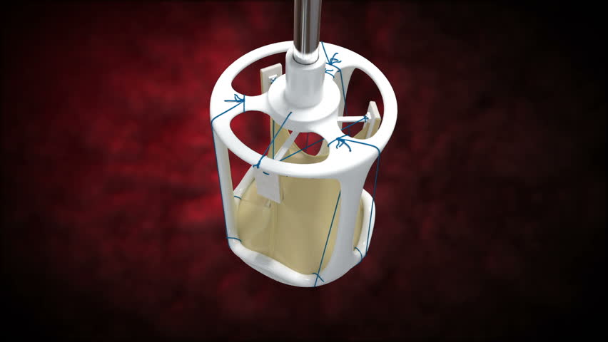Top to side, close-up, view of cardiac valve for aortic valve replacement surgery following myocardial infarction or leaky valves