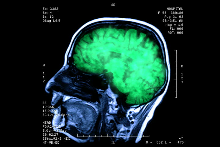 Brainstorm (NTSC)
