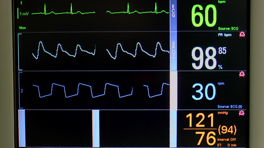 Close up of patient monitor displays vital signs, EKG, oxygen saturation (SPO2) respiration and blood pressure. 1080p