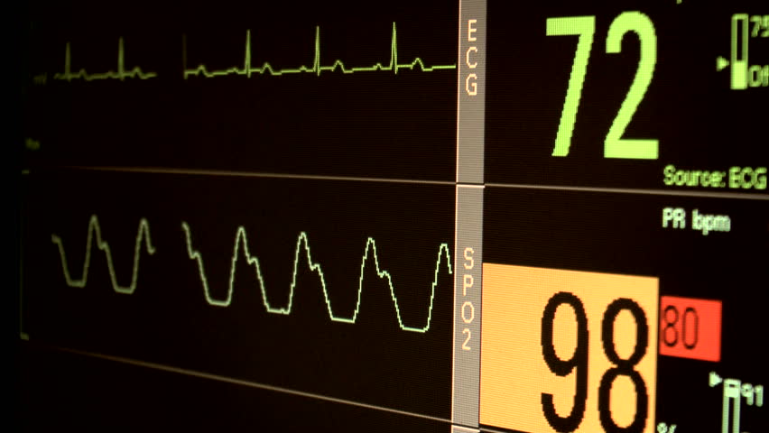 Patient hospital monitor flashes colorful EKG or ECG, SPO2 or oxygen saturation readings. 1080p 