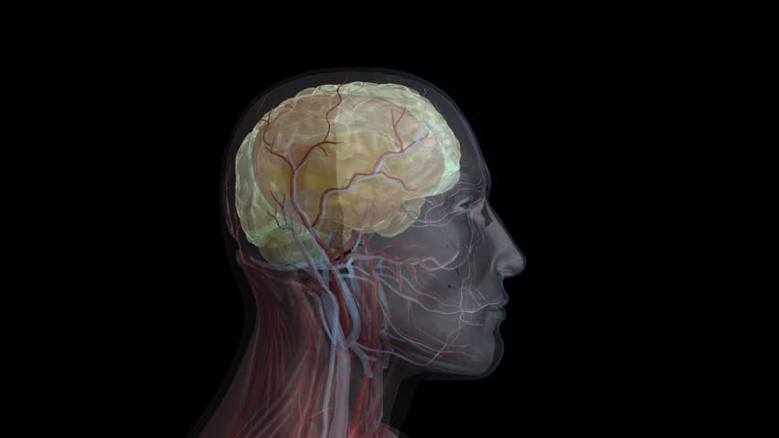 Perspex head showing isolated damage to brain frontal lobe after a thrombus or embolus causing decreased perfusion to the region of nervous/brain tissue