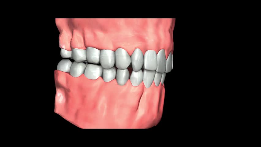 medical, medicine, nurse, operation, recovery, tongue,
incisor, canine, molar, premolar, gum, root canal therapy, 
