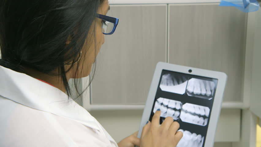 A female dentist or intern reviewing a dental x-ray explains what she sees to a patient who is off camera
