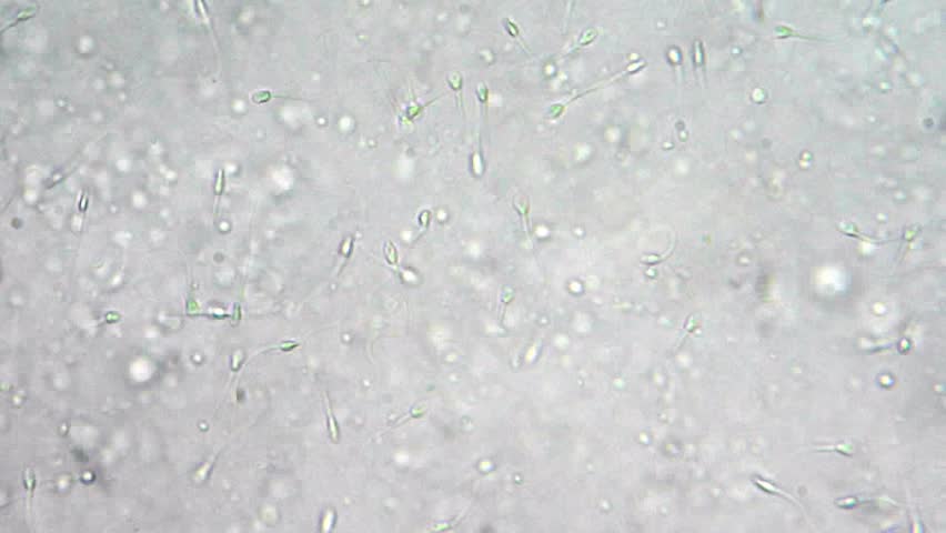 Sperm motion of health man under microscope, magnification 1000X