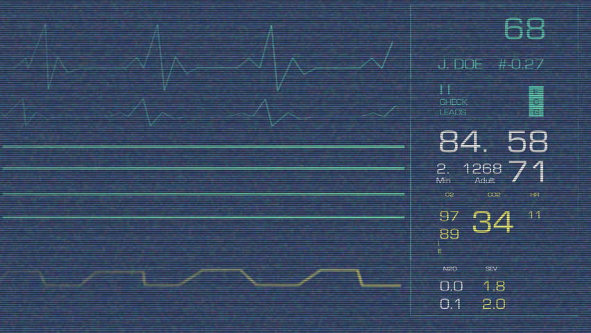 Heart Monitor
