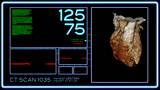 A fictional hospital computer screen monitoring a human heart.
