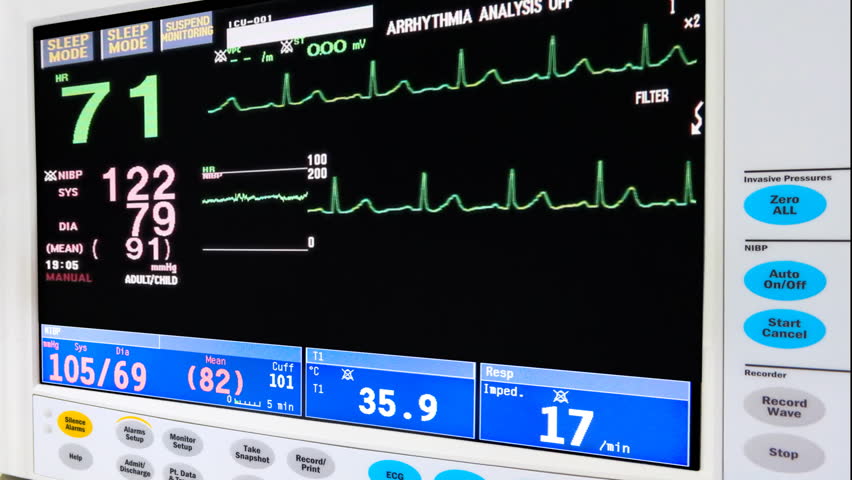 intensive care unit ECG monitor