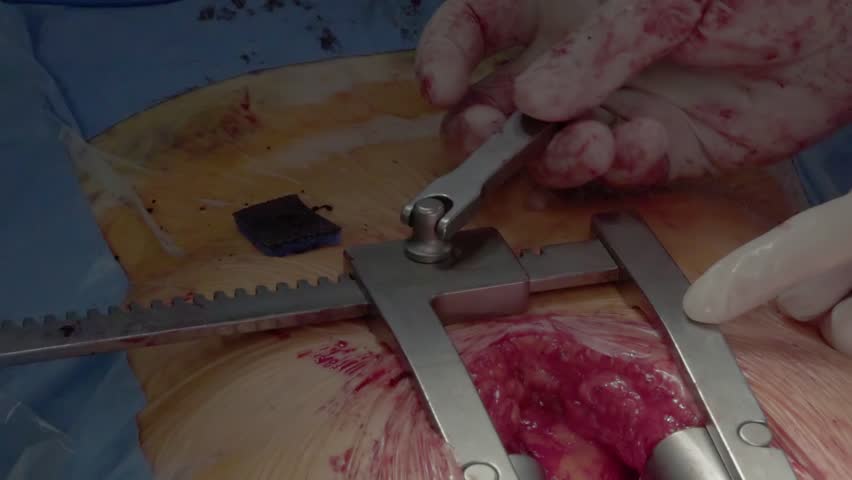 Header of retractor