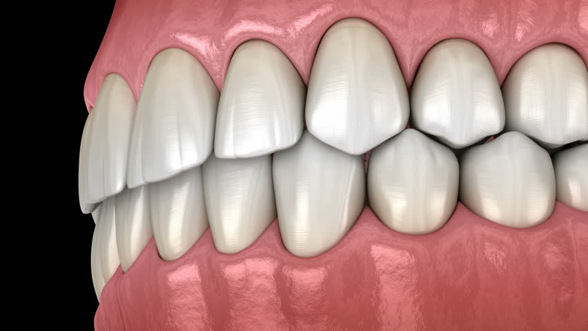 Healthy Human Teeth with Normal Stock Footage Video (100% Royalty-free