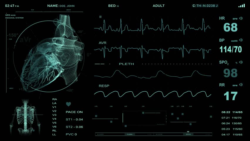 Cardiac Monitoring. Heart Monitor. Electrocardiography. Stock Footage