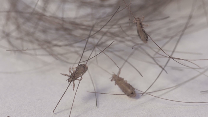 Lice Insects On Human Dyed Hair Clump Macro