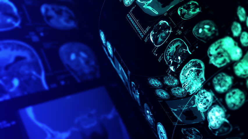 Stock video of medical, clinical background. ct scans, x-ray | 15338578 ...