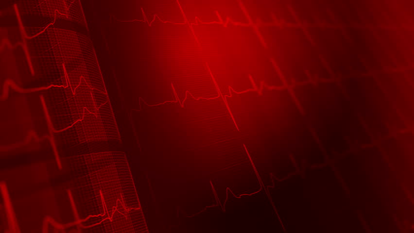 Heart Rate Electrocardiogram Ecg Medical Stock Footage 