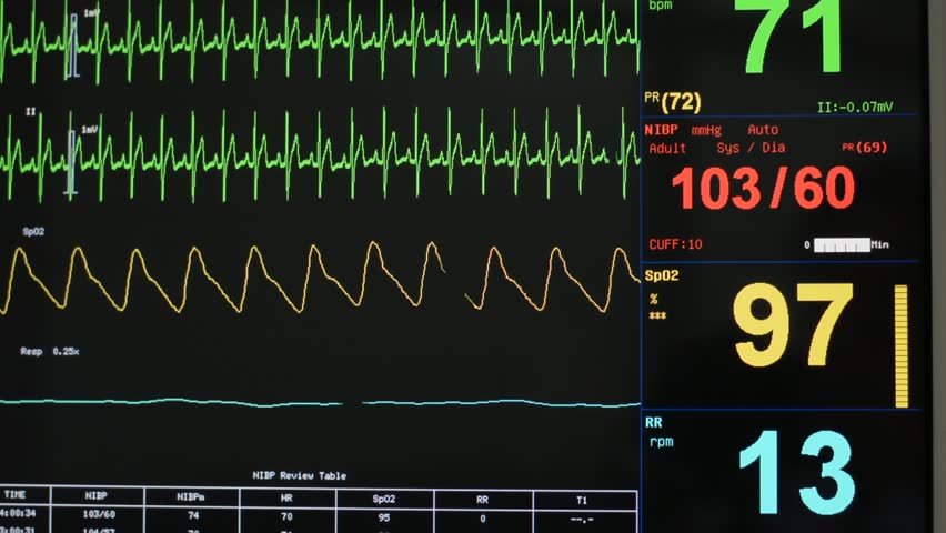 Patient Screening Checkup Displays ECG Or EKG Heart Rate, SP02 Or ...