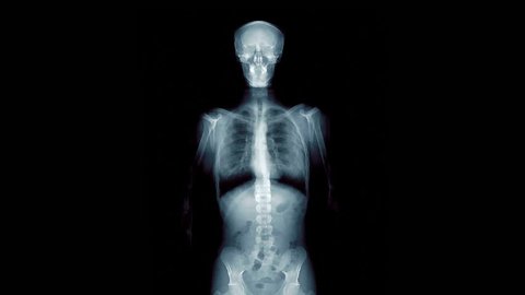 Skeleton And Moving Chest X Ray Stock Footage Video 100 Royalty Free Shutterstock