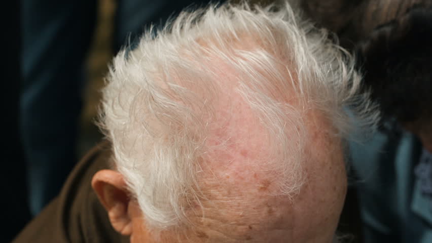 Balding Head Of Old Man Stock Footage Video 100 Royalty Free