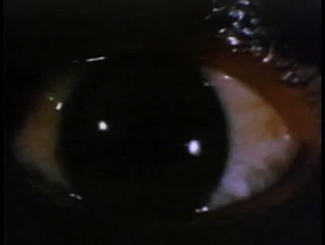 Header of bloodshot