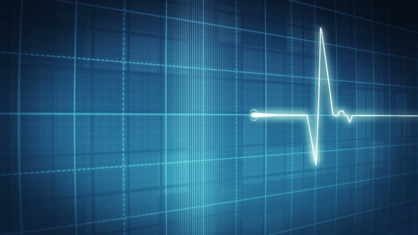 an animated heart monitor ekg line with sound and alpha a c pressure chart