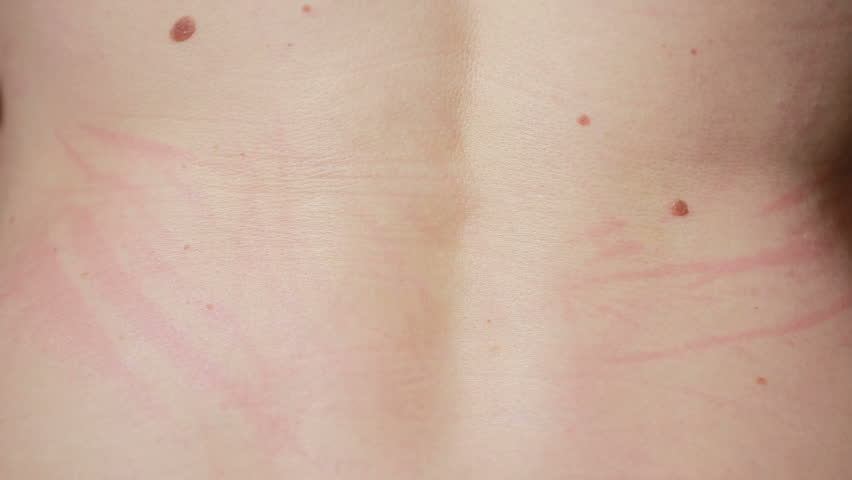 Pure colon detox resultados photo 2