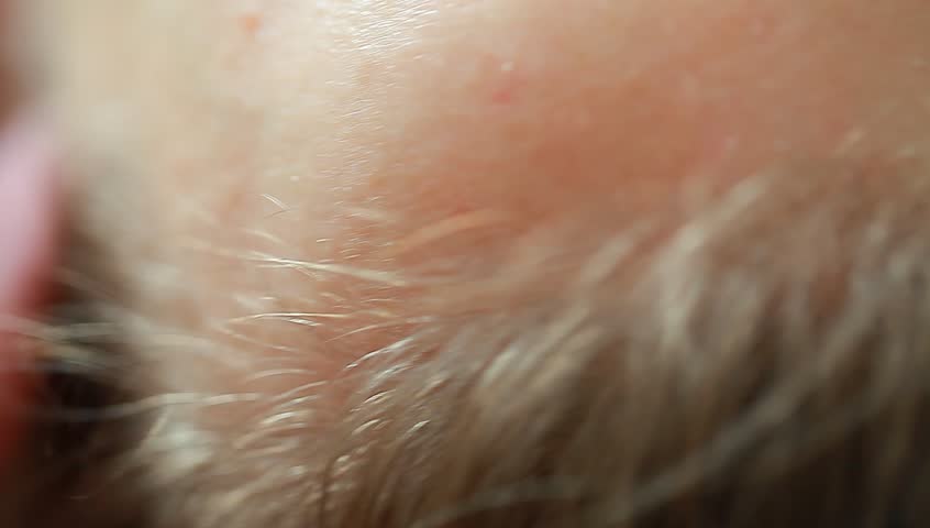 Header of Acupressure