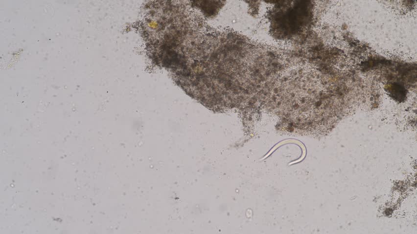 Header of threadworm