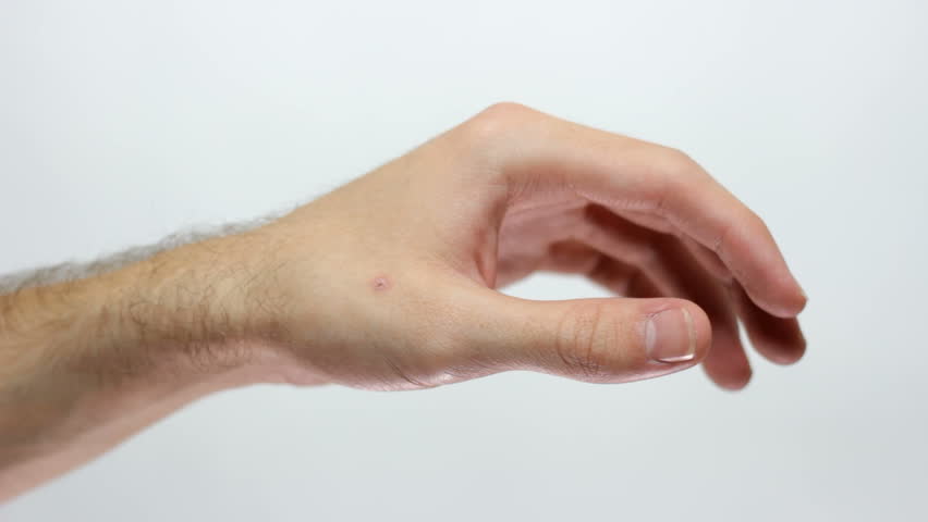 Header of carpal