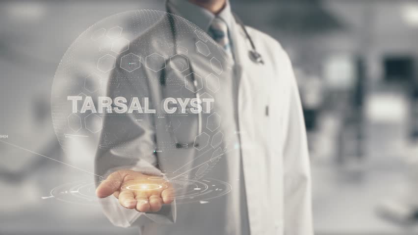 Header of tarsal