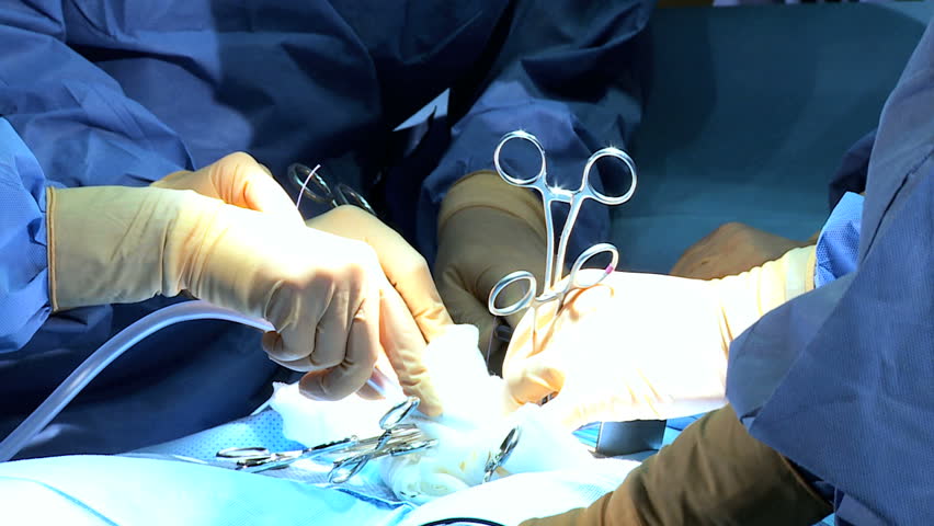 Patient POV Faces Hands Male Female Surgeons Nurses Wearing Surgical ...