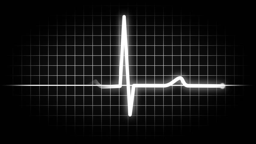 Stock Video Clip of An animated heart monitor EKG flatlines. | Shutterstock