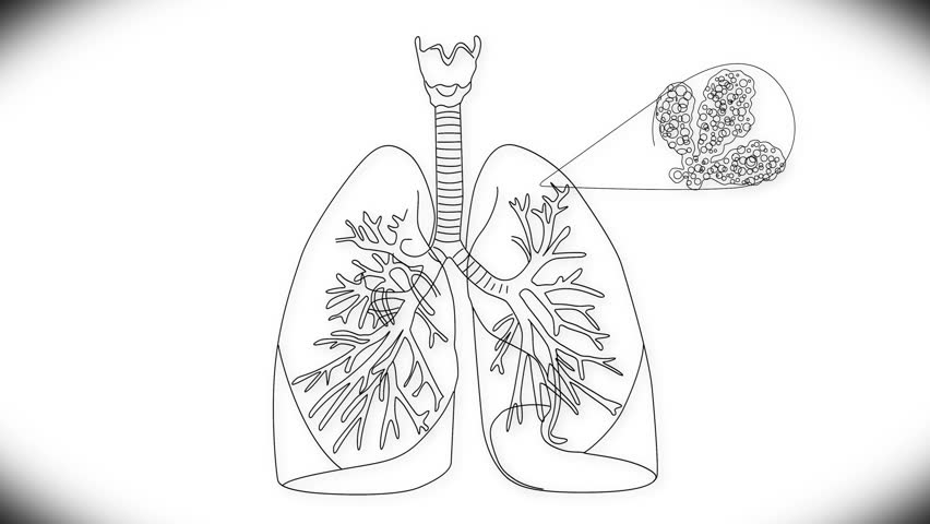 Human Lung Structure Animation Illustration Arkivvideoopptak 2689181