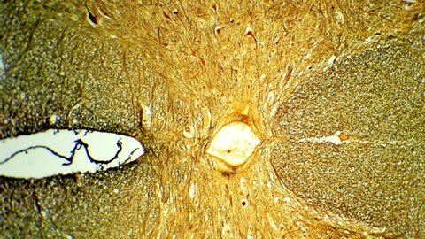 Фото препаратов поперечных срезов. Поперечный срез спинного мозга микропрепарат. Поперечный срез спинного мозга микроскоп. Микропрепарат «спинной мозг», импрегнация серебром. Спинной мозг азотнокислое серебро.